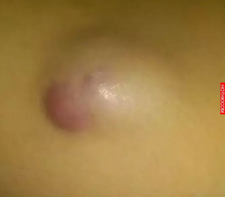 男人身上的10個癌症現像，妳的家人恐怕會有！！！