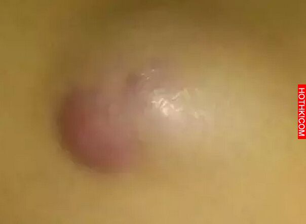 男人身上的10個癌症現像，妳的家人恐怕會有！！！