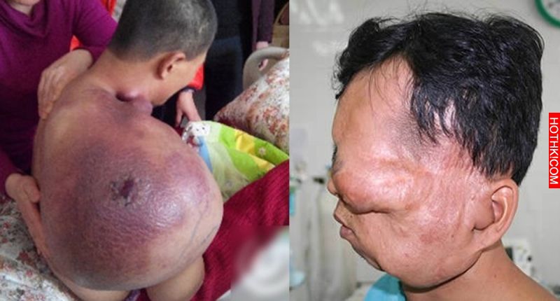 老和尚全靠吃這個，惡性腫瘤全消失！