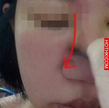 眼袋有救了! 不用動刀，只要一個動作！秒速年輕10歲！