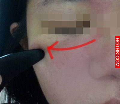 眼袋有救了! 不用動刀，只要一個動作！秒速年輕10歲！