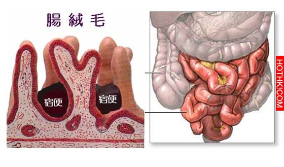 叫人不死，腸中須無屎！每天喝一杯，排體內毒、清腸、大肚腩變平、除口臭！才三天就一 ...