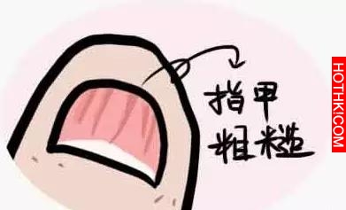 藏在指甲上的小秘密！看完我趕緊自查了一下！