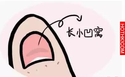 藏在指甲上的小秘密！看完我趕緊自查了一下！