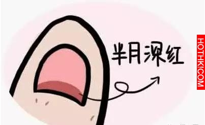藏在指甲上的小秘密！看完我趕緊自查了一下！