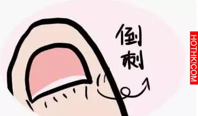 藏在指甲上的小秘密！看完我趕緊自查了一下！