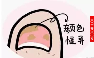 藏在指甲上的小秘密！看完我趕緊自查了一下！