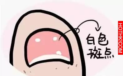 藏在指甲上的小秘密！看完我趕緊自查了一下！