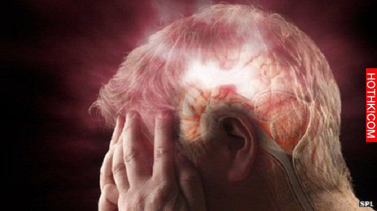 當年我阿公就是這樣走的，如果早點知道這四種水果可以防中風就好了.....千斤難買早知 ...