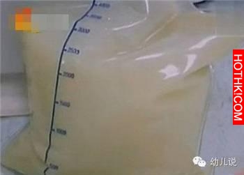 孕婦產檢竟從血管抽出白色液體！ 醫生的解釋讓人揪心