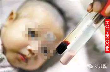 孕婦產檢竟從血管抽出白色液體！ 醫生的解釋讓人揪心