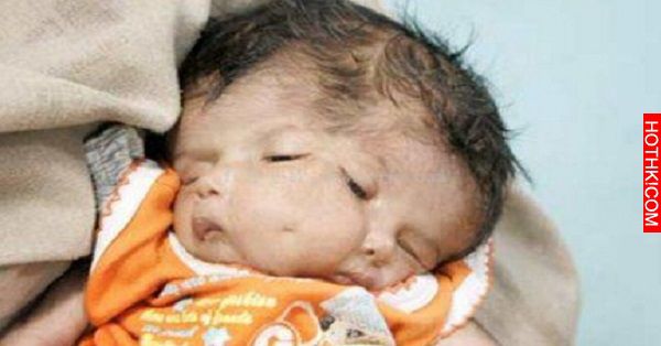 這對夫妻生下了「雙面寶寶」，只因丈夫在老婆懷孕時做了「一件事」...全天下父母都該 ...