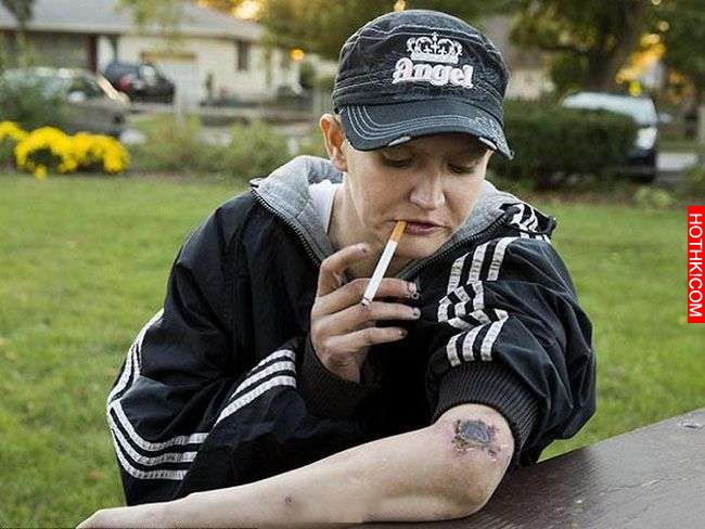 他注射世界上最可怕的「喪屍毒品」後，身體竟然被腐蝕！還出現這些恐怖的慘狀...讓他 ...