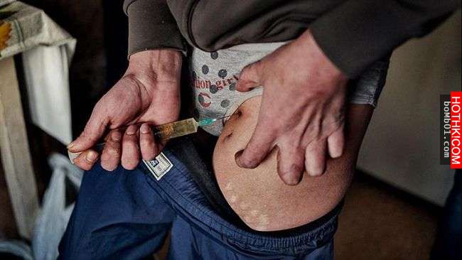 他注射世界上最可怕的「喪屍毒品」後，身體被腐蝕的痛苦讓他後悔到想自殺！ ...