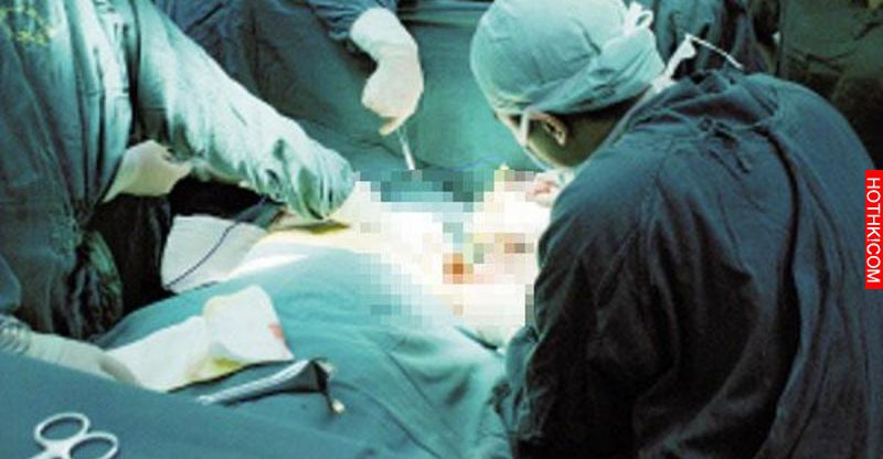 為了讓老婆生育，他竟然不聽醫生勸阻，把妻子「肛門」切了！妻子醒來竟然... ...