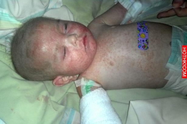 兩歲寶寶遭受痛苦，媽媽請求結束兒子生命