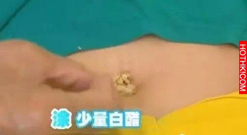 女友便祕跟「腸胃科醫生」男友訴苦，想不到醫生男友竟然叫女友做「這種事」...這太過 ...