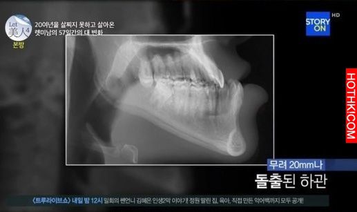 癡情怪咖男表白慘遭拒，沒想到大改造後竟然.....
