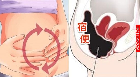 「宿便」讓你肥10公斤！每天只做10下，宿便就輕鬆鏟光了！一排到底有多爽，試過就知道 ...