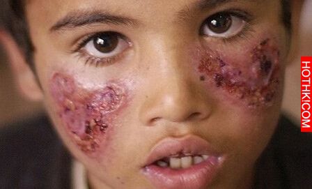 ISIS「伊斯蘭國」開始發動「喪屍戰」，到處散播致命病毒...這些國家遭殃了！ ...
