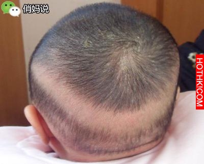 藏在寶寶身上的7個「小秘密」，無數爸媽至今不知道真相！