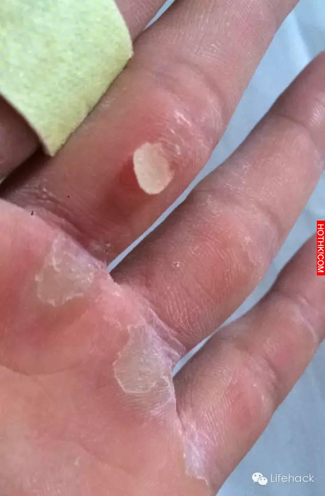 你只看到他們的肌肉，卻沒看到他們的雙手！