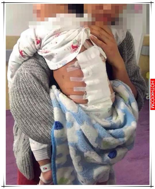這個寶寶才16個月，愛跑愛跳的他卻突然站也站不住，只因為這一顆小小膿包導致癱瘓... ...