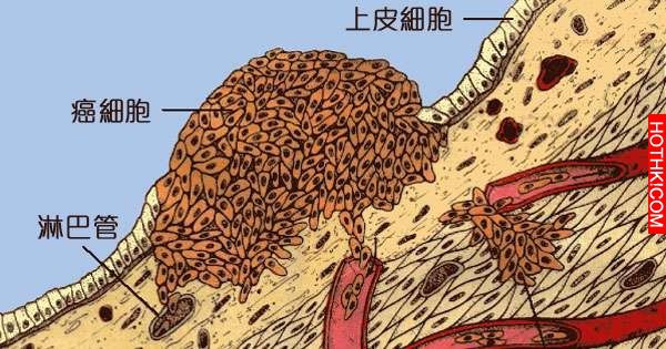 日本人靠著「喝白開水」就能預防癌細胞滋生，關鍵就在於一個簡單到不行的步驟！ ...
