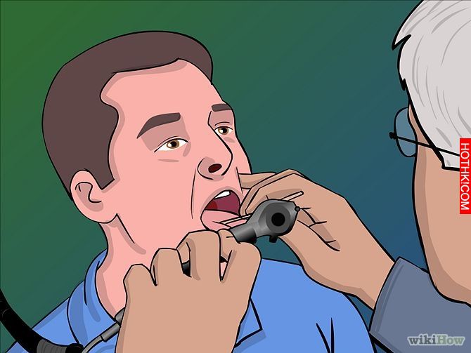 Image titled Remove Tonsil Stones (Tonsiliths) Step 17