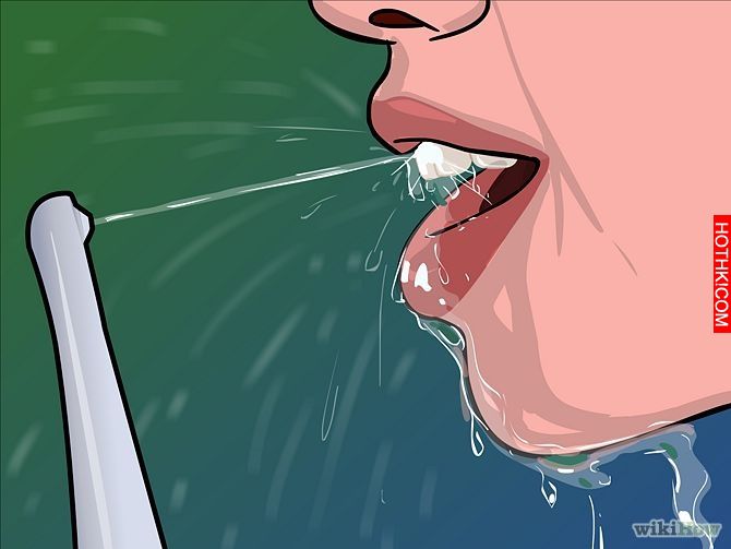 Image titled Remove Tonsil Stones (Tonsiliths) Step 10