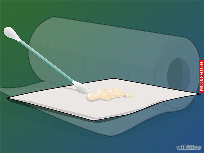Image titled Remove Tonsil Stones (Tonsiliths) Step 6