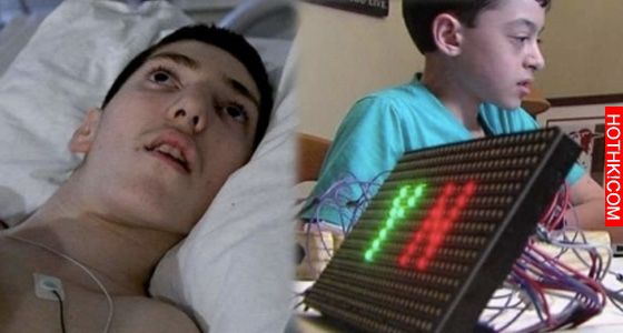 這個男孩被閃電擊中後成了植物人,當大家都放棄時,他才13歲的好友竟為男孩發明了... ... 這個男孩被閃電擊中後成了植物人,當大家都放棄時,他才13歲的好友竟為男孩發明了... ...
