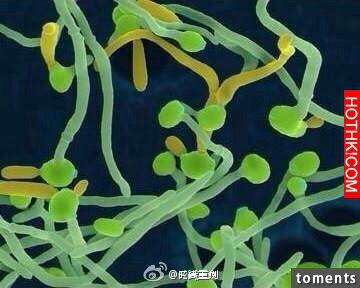 念珠菌陰道炎(VVC)--不能說的秘密