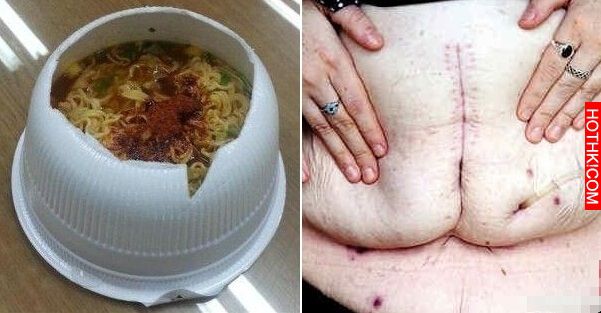 這婦人吃泡麵時配了「某種東西」...胃瞬間爆炸了！還在這樣吃的人千萬要注意！ ...