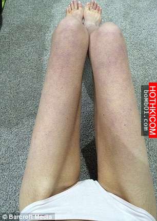 這女孩一個禮拜不吃不喝，不只骨頭跑出來見人...就連胸部都變成這種可怕的樣子！ ...