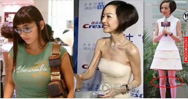 來看看「頭不對身」的明星～看到最後一個嚇呆了！他簡直是外星人吧？！ ...