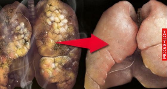 超神奇!這個女孩塗了「一樣東西」在鼻子上,「鼻頭粉刺」竟然立刻脫落!它就在你身邊 ... 超神奇!這個女孩塗了「一樣東西」在鼻子上,「鼻頭粉刺」竟然立刻脫落!它就在你身邊 ...