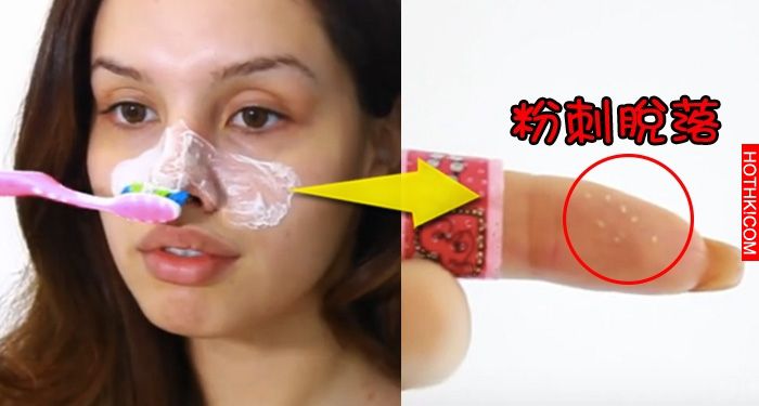 超神奇！這個女孩塗了「一樣東西」在鼻子上，「鼻頭粉刺」竟然立刻脫落！它就在你身邊 ...