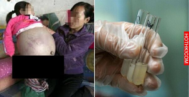這男人癌症後把他的精子冷凍「23年」...最終讓老婆懷孕...生下的孩子竟然.... ...