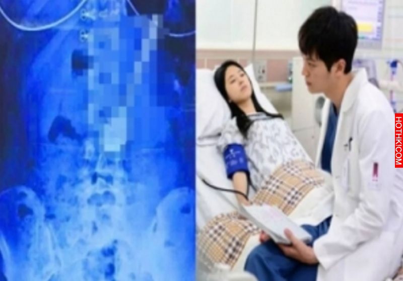 醫生問病患怎麼了，結果她拿出的X光片竟讓現場人員嚇壞了！原來有根「長長硬硬」的東 ...