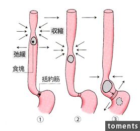 醫生問病患怎麼了，結果她拿出的X光片竟讓現場人員嚇壞了！原來有根「長長硬硬」的東 ...