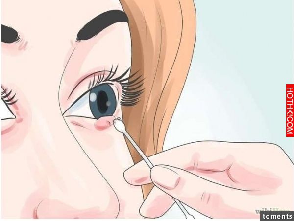 眼睛突長針眼，原來是「這個東西」引發的炎症！若早上起來發現「針眼」第一件事千萬別