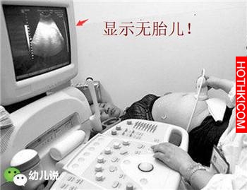 懷孕4年有胎動，卻無醫院肯接收！ 孕婦到底懷的是什麼&ldquo;東西&rdquo;？