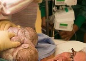 41歲孕婦剖腹產雙胞胎，就在嬰兒出生的那一刻，她竟然做了這個舉動！醫生看了超震驚！ ...