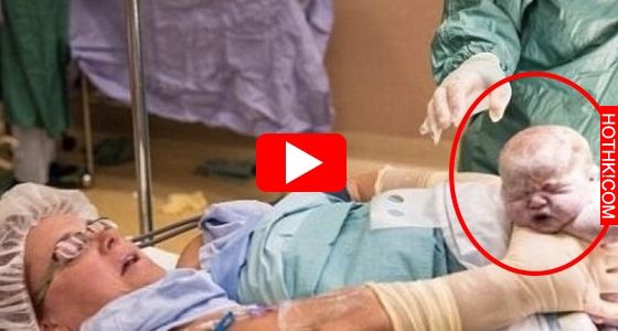 41歲孕婦剖腹產雙胞胎，就在嬰兒出生的那一刻，她竟然做了這個舉動！醫生看了超震驚！ ...