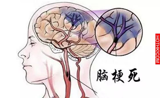 每天只要一杯，避免腦梗塞及心肌梗塞，務必要看喔！自己的生命自己救阿！！ ...
