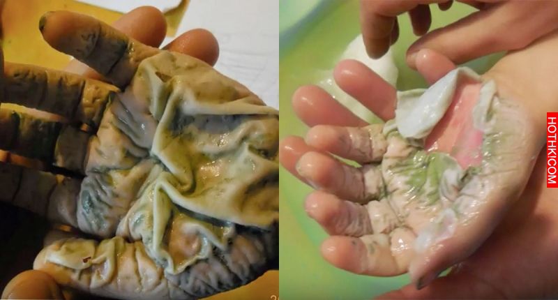 冬天腿上多層「蛇皮」「魚鱗皮」怎麼辦？只要多這一步，包準你三天內水嫩到會反光！就 ...