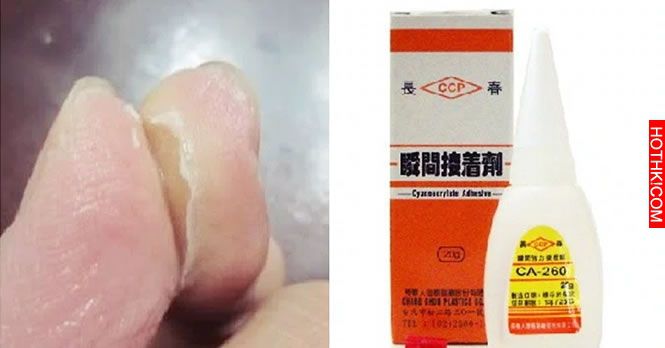 被強力膠緊緊粘住千萬不要慌張，看完這個你的手就可以很快得到解放了 ...