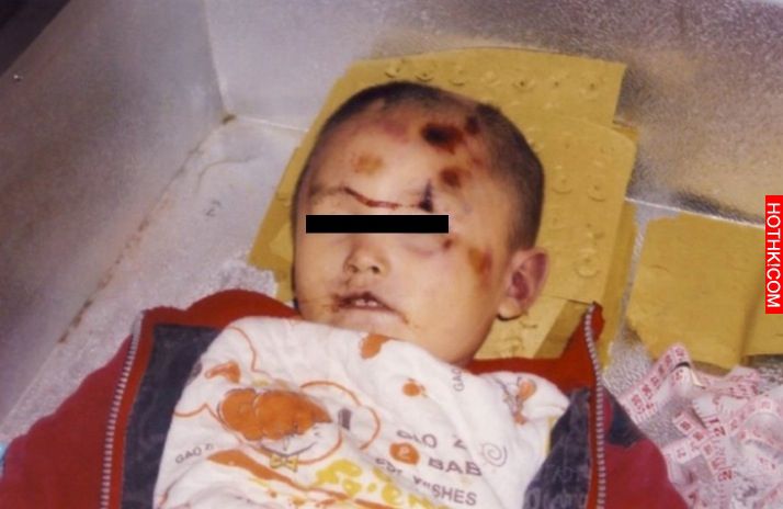 媽媽抱著3歲孩子跑到醫院急救，醫生檢查發現孩子瞳孔放大已經回天乏術...一問之下才發 ...
