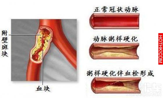 下面每一種食物 ，都是血液垃圾的天敵看完不要驚訝！尤其是三十歲以後還不吃就晚了... ...